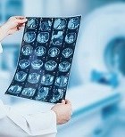 MRI מוח - תמונת המחשה